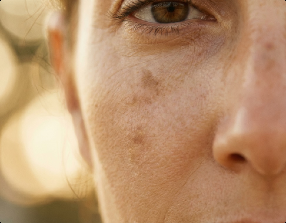 Pigmentation Control