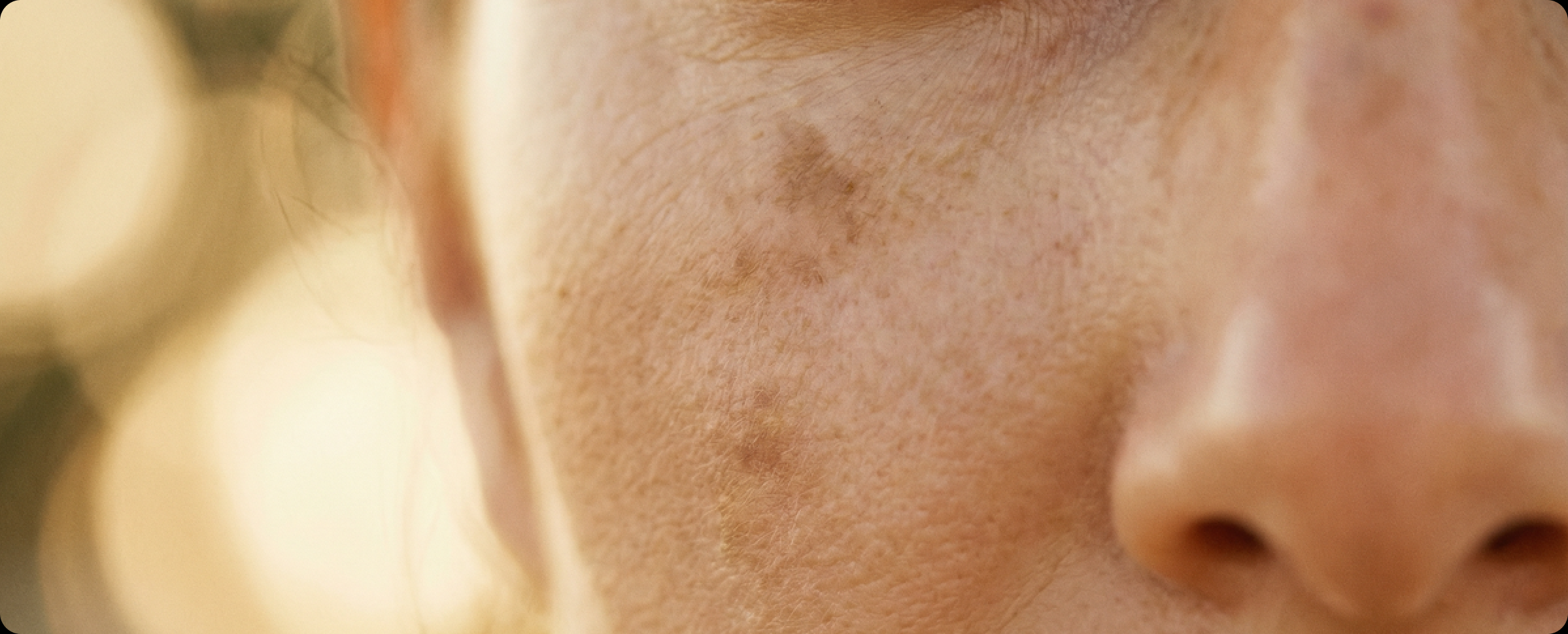 Pigmentation Control